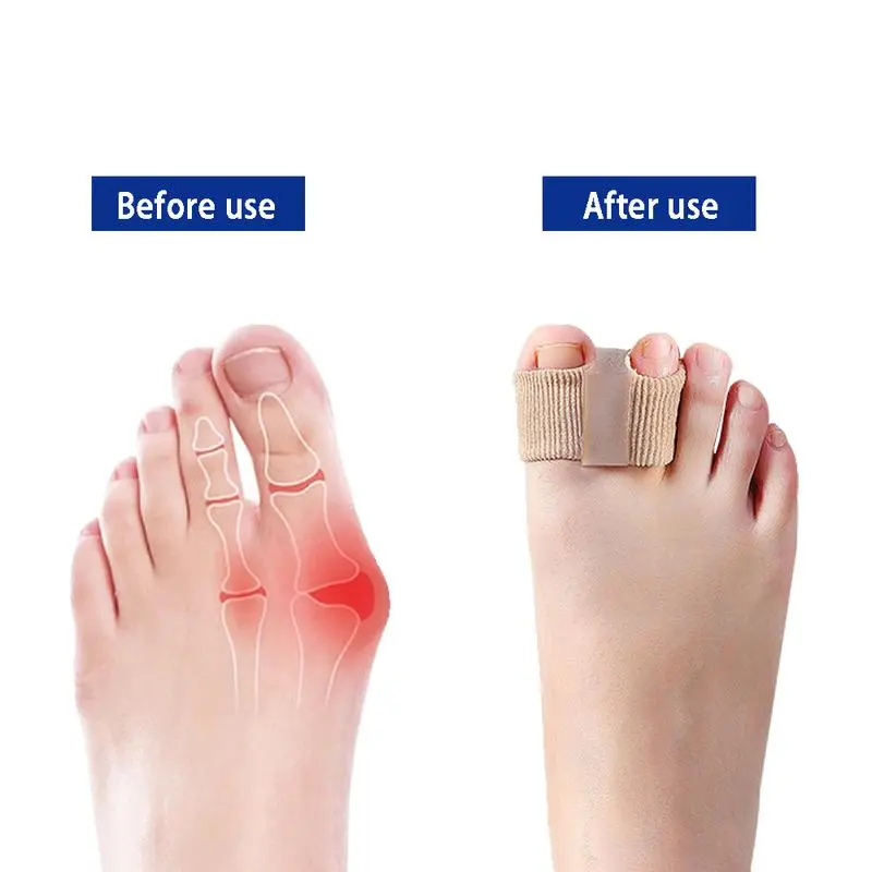 [Buy 1 get 1 free]Bunion Reliever Comfortable and durable Bunion Support for Walking, Running, Hiking Shoes toe separator corrector shock  absorbing  insoles bunion reliever, Foot Pain Relief