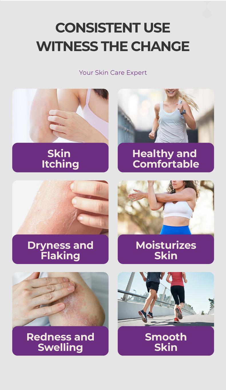 Skin Soothing Cream 20g/Tube, Gentle Relief for Itchy, Red & Flaky Skin, Daily Body Care Essential