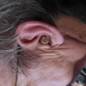 Audien Atom ONE Complete Care Bundle