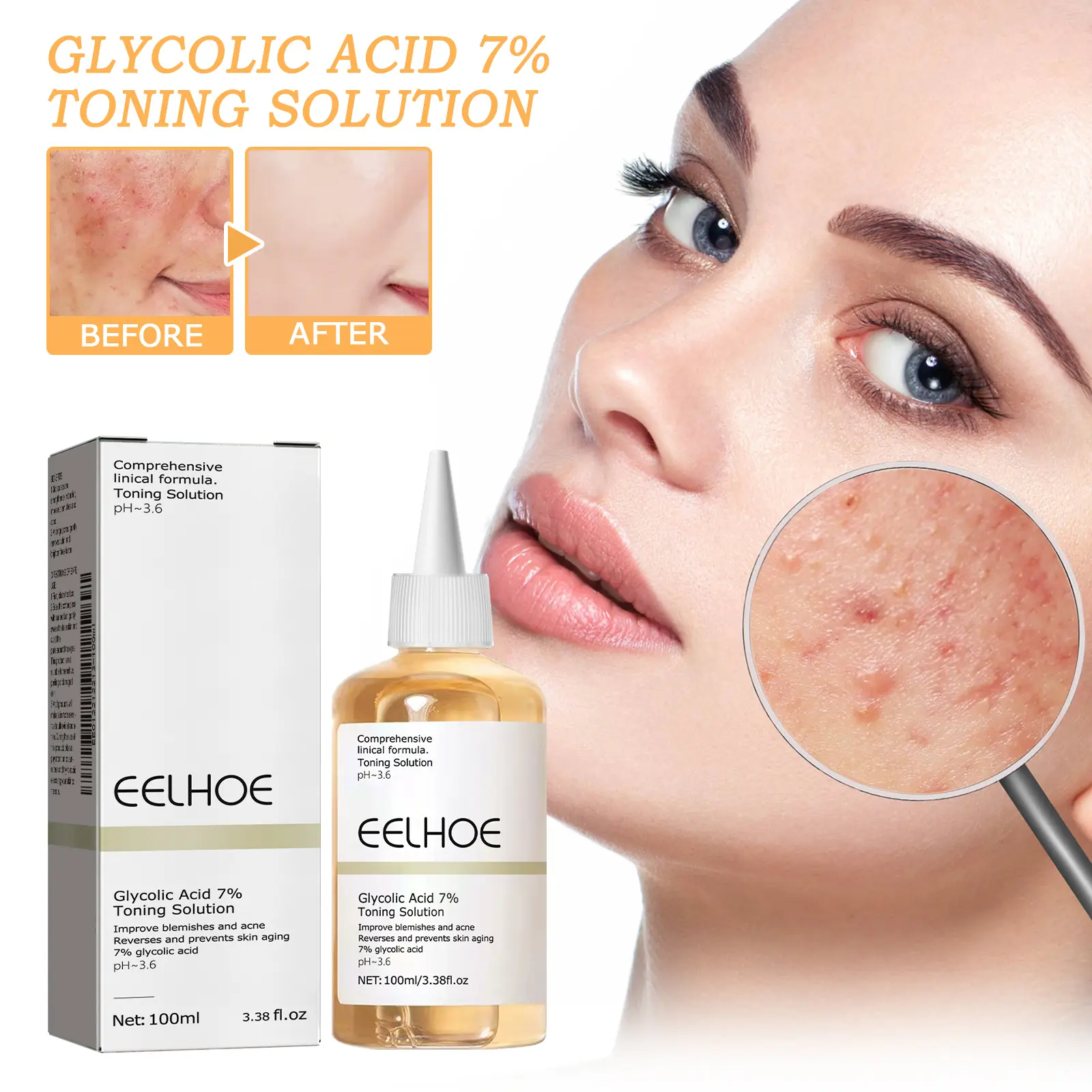 7% Glycolic Acid Exfoliating Toner, Gentle Exfoliating Toner, Smooth Skin, Restores Skin Vitality and Refreshing, Hydrating Formula, Pore Minimizer