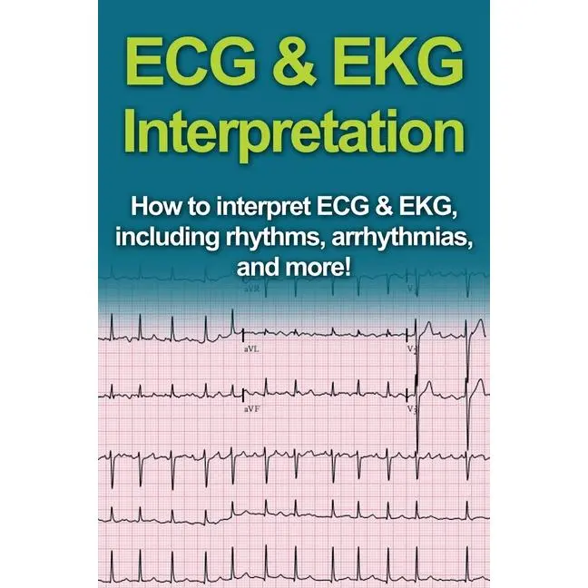 ECG & EKG Interpretation: How to interpret ECG & EKG, including rhythms, arrhythmias, and more! by Jeremy Pine (Paperback)