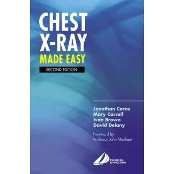 USED-Chest X-Ray Made Easy by Jonathan Corne MA  PhD  MB BS  FRCP (Paperback)