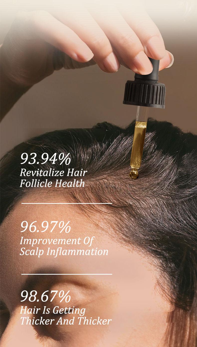 Gypsophila Batana Oil&Rosemary Oil - Hair Growth, Nourish Scalp & Detox for Strong & Healthy Hair - 30 mL Haircare with Organic Batana nourish hair natural oil Gypsophila Batana Oil&Rosemary Oil - Hair Growth, Nourish Scalp & Detox for Strong & Healthy Hair - 30 mL Haircare with Organic Batana nourish hair natural oil