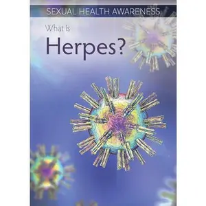 USED-What Is Herpes? by Connors, Kathleen (Paperback)