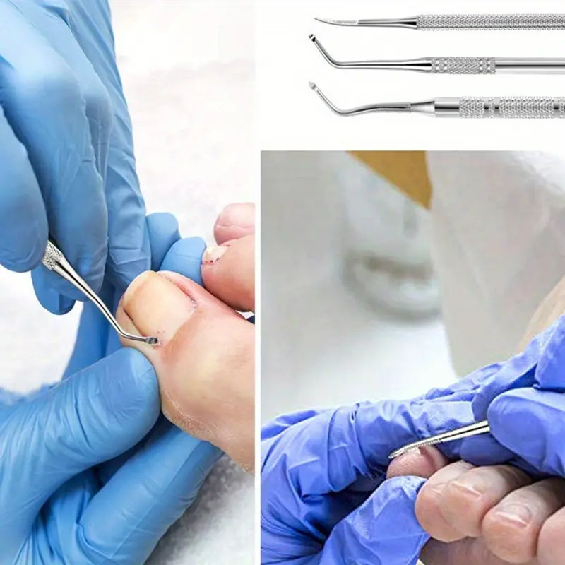 2pcs Stainless Steel Ingrown Toenail Tool, Toenail File And Lifters, Professional Surgical Safe Nail Treatment Pedicure Tool Kit Nail Cleaner Tools Pain Relief Nail Care Tool Set, Nail Supplies