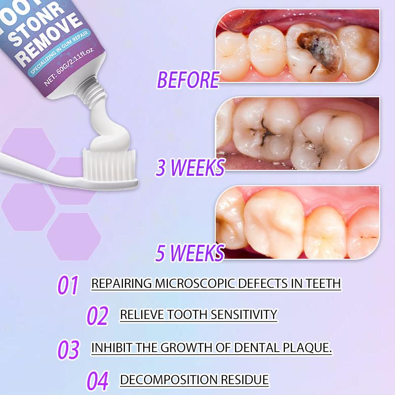 ZKRICARO Anti-Cavity Repair Toothpaste FDA Certified Cavity Repair Whitens Teeth Strengthens Enamel Relieves Sensitivity & Bad Breath