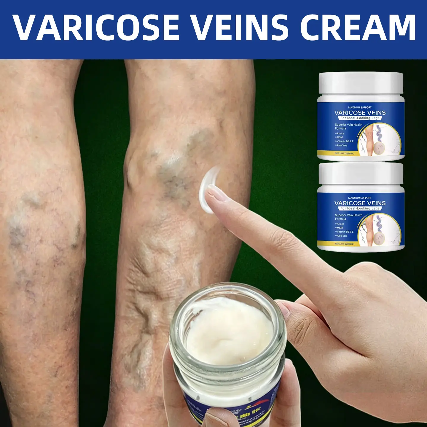 Varicose veins cream improves varicose vein protrusions, reduces pigmentation, relieves leg stiffness and pain, supports daily leg care through application and massage for a smooth appearance.