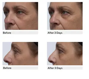 philosophy mega size hope water cream 8oz