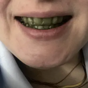 （Ceelike） 7-Day Teeth Strips | Removes Stains & Protects Enamel | Enhances Natural Shine |Balances Oral Health