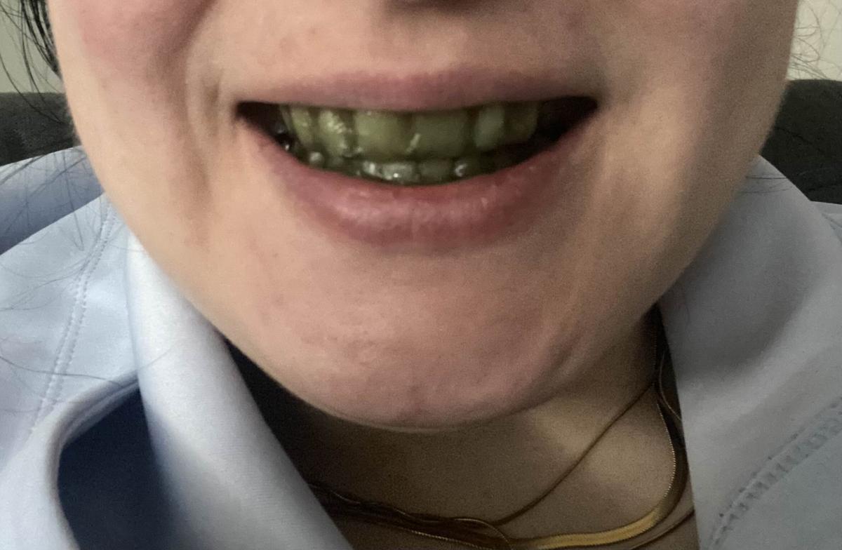 Item: 1 PACK -14 STRIPS