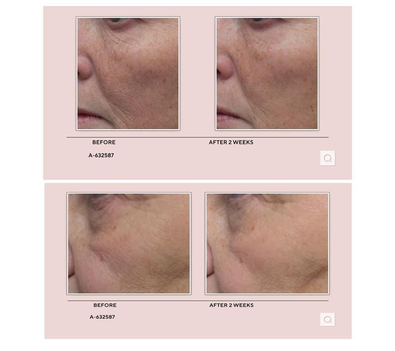 ELEMIS Pro-Collagen Marine Cream with Discovery Set