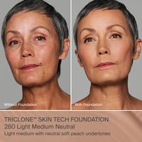 280 Light Medium Neutral