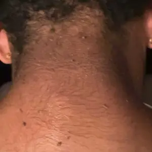 Product Review of [Dr.Melaxin Official] Peel Shot Glow Rice Ampoule Duo - Serums for Brightening, Exfoliating, and Moisturizing - Suitable for All Skin Types from M**a T**f