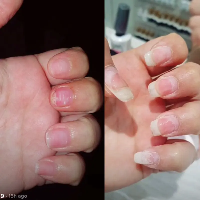 Radiant Cosmetics Nail Growth Oil - 100% Organic, Moisturizing, Growth, Strengthening, and Brightening Formula with Vitamins and Fatty Acids for Overall Nail Health 6