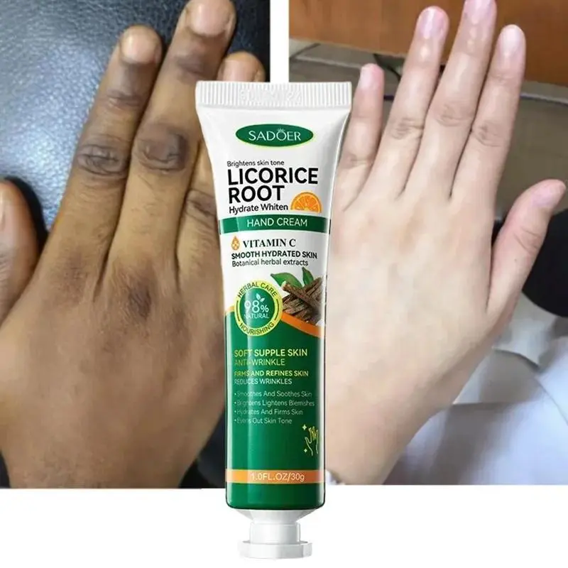"Brighten Dark Knuckles Fast! Intense Whitening Hand Cream for Women - Removes Stubborn Stains & Corrects Melanin - Deep Moisturizing Care - From Rough to Radiant in 14 Days - Try Now!"