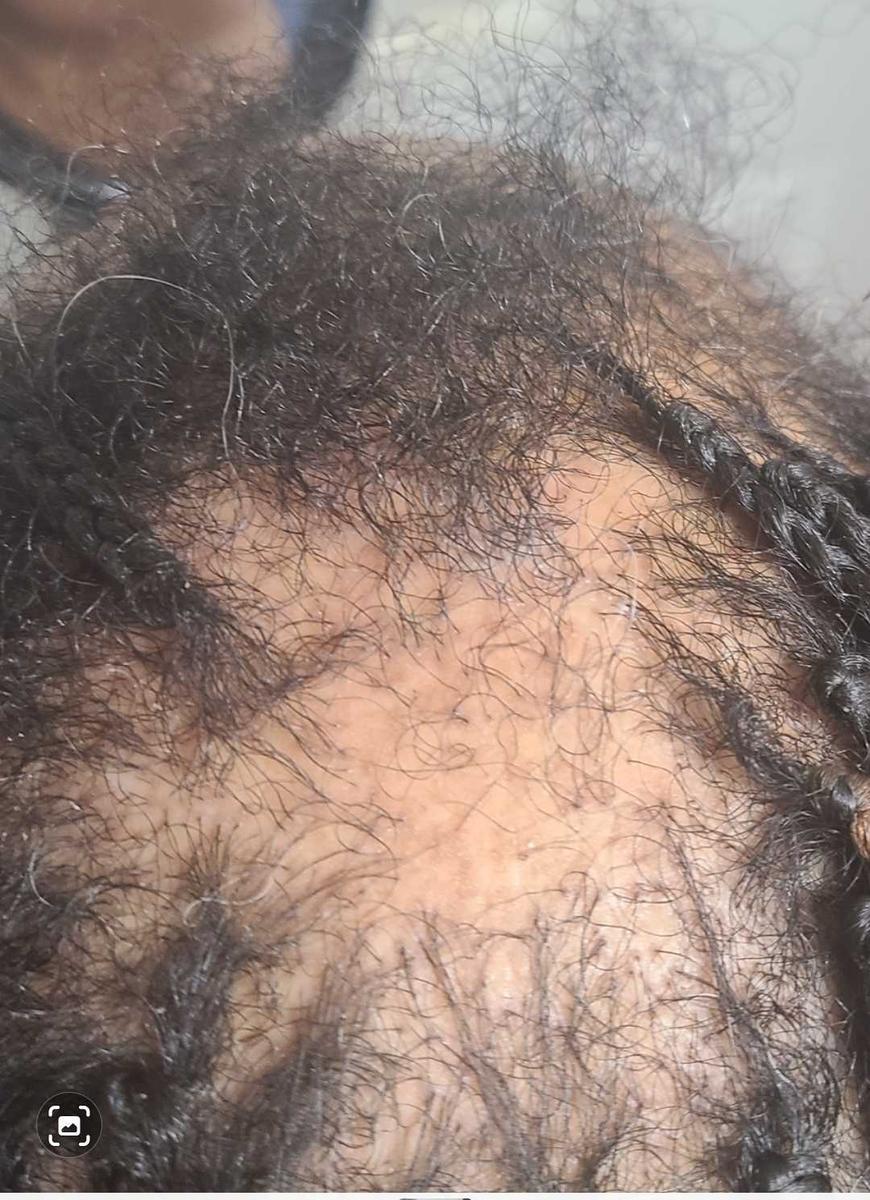 Item: DLHF-HGM-Bundle