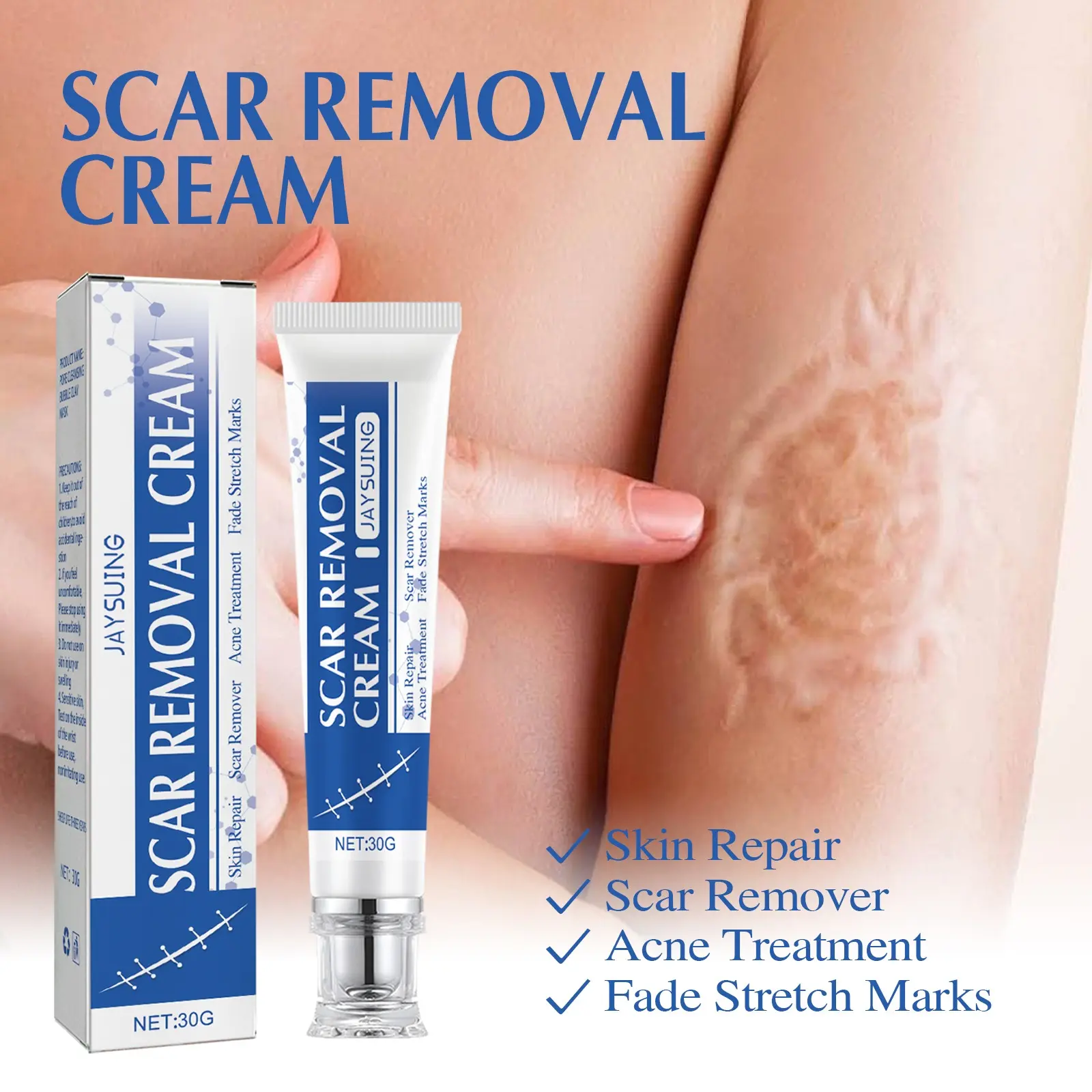 Professional Silicone Scar Removal Gel, Advanced Scar Treatment Cream for Old Scars, Acne Scars & Burn Marks, Face & Body Scar Fading Formula with Natural Ingredients, Gentle Skin Care