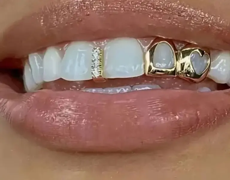 14K Gold Plated Iced CZ Gap + Double Open Face Heart Grillz Set