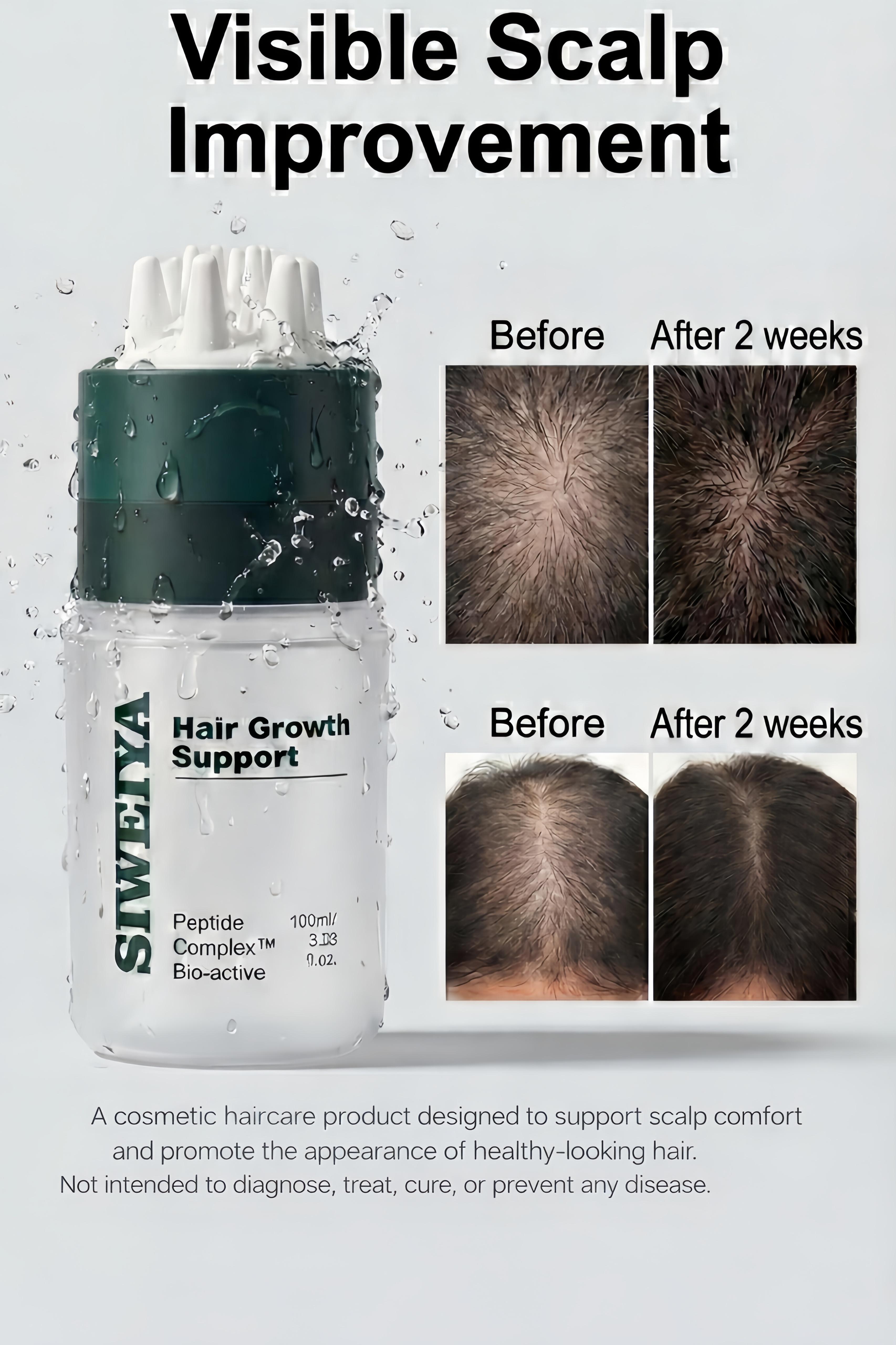Korean Hair Growth Scalp Serum  with Built-in Scalp Massager— Peptide Complex Formula for Thinning Hair, Supports Fuller-Looking Strands, Plant-Based Bio-Active Care to Strengthen Roots & Soothe Scalp, Scalp Care Product. Haircare product, 100 ml