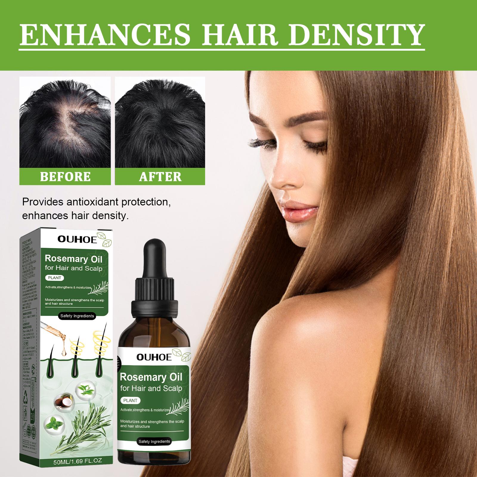 Rosemary Hair Oil，It clears away excess oil, dirt and dead skin cells on the scalp, nourishes the scalp and helps minimize hair shedding. It boosts scalp circulation, nourishes hair roots and replenishes nutrients essential for healthy hair growth.