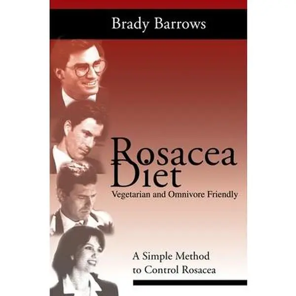 USED-Rosacea Diet: A Simple Method to Control Rosacea by Barrows, Brady (Paperback)