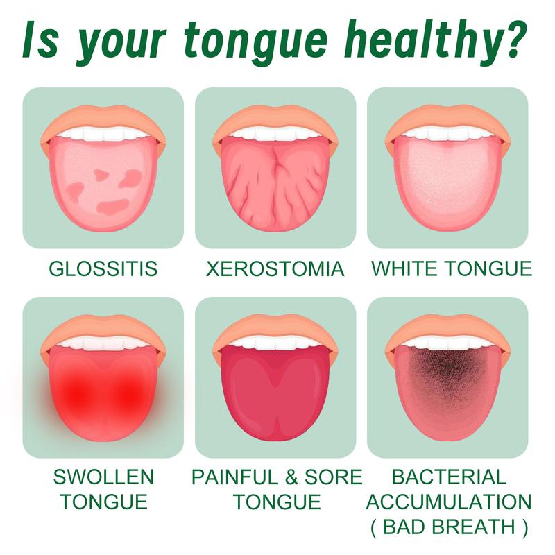 Tongue Repair Spray - Soothes White Coating, Relieves Dryness & Swelling - Oral Care Solution for Healthy Tongue & Fresh Breath
