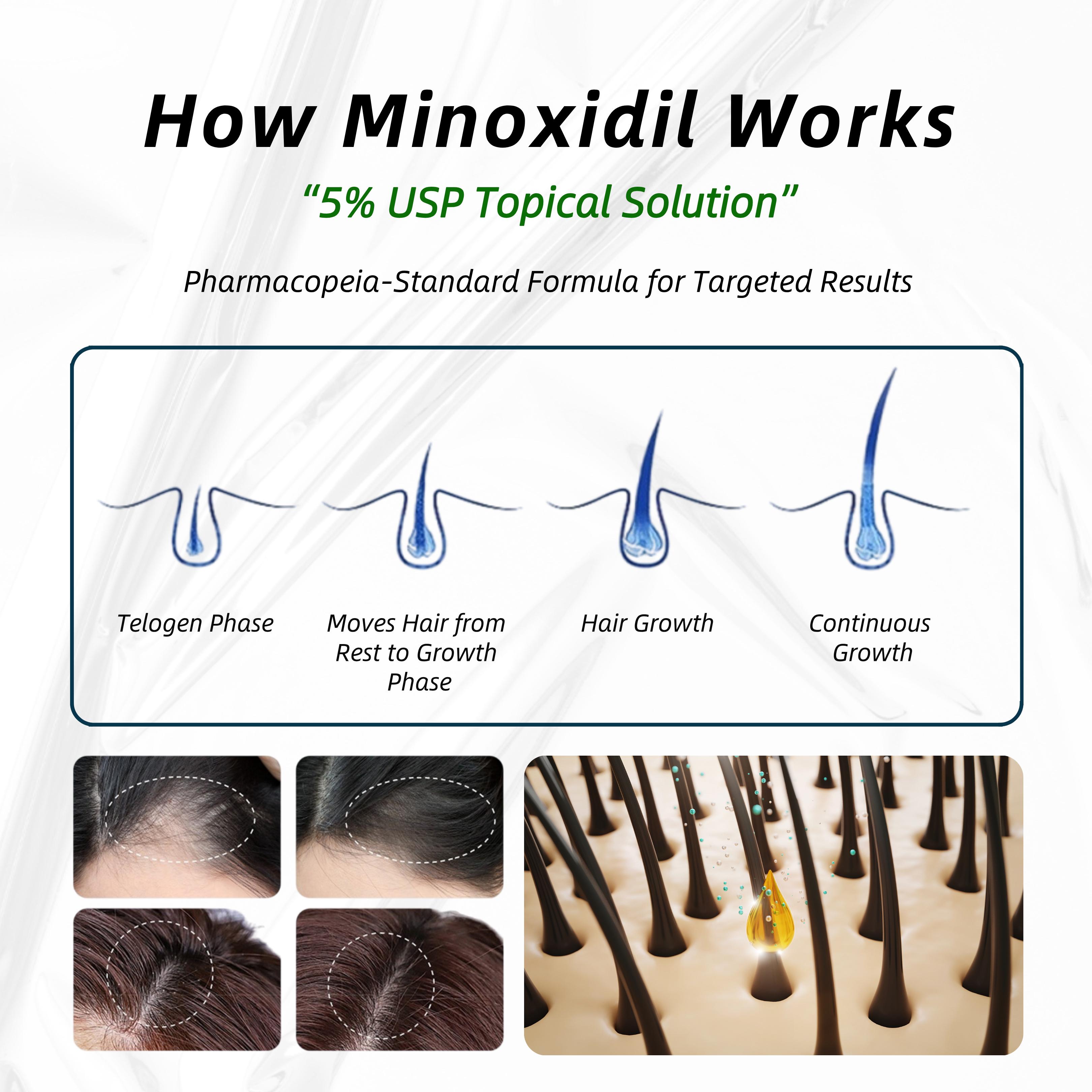 DelvoLisi [FDA Certified] Professional Gentle Hair Growth Toner and Botanical Hair Care Series - Contains natural plant ingredients and scalp extracts to effectively reduce hair loss | Suitable for both men and women