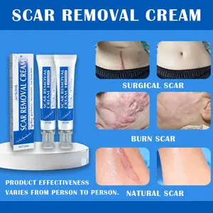 Professional Scar Removal Gel Advanced Silicone Fade Smooth Renew Keloids C-Section Surgical Burns Acne Marks Healthcare