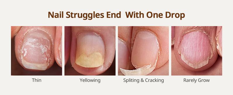 BTArtboxnails Naillush Nail Growth Oil - Nail Strengthener & Growth Repair Damaged Nails, Strengthen Weak & Thin Nails, Extra Strong Nail Growth Treatment, Long Lasting Nail Hardener, 15ml