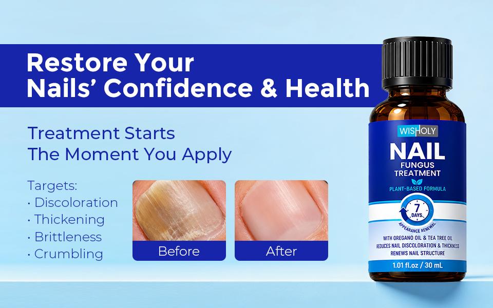 WISHOLY Nail Fungus Treatment for Toenail & Fingernail - Extra Strength Repair Liquid with 1% Tolnaftate, Tea Tree Oil & Oregano Oil - Restores Yellow, Thick & Damaged Nails - 1.01 fl oz