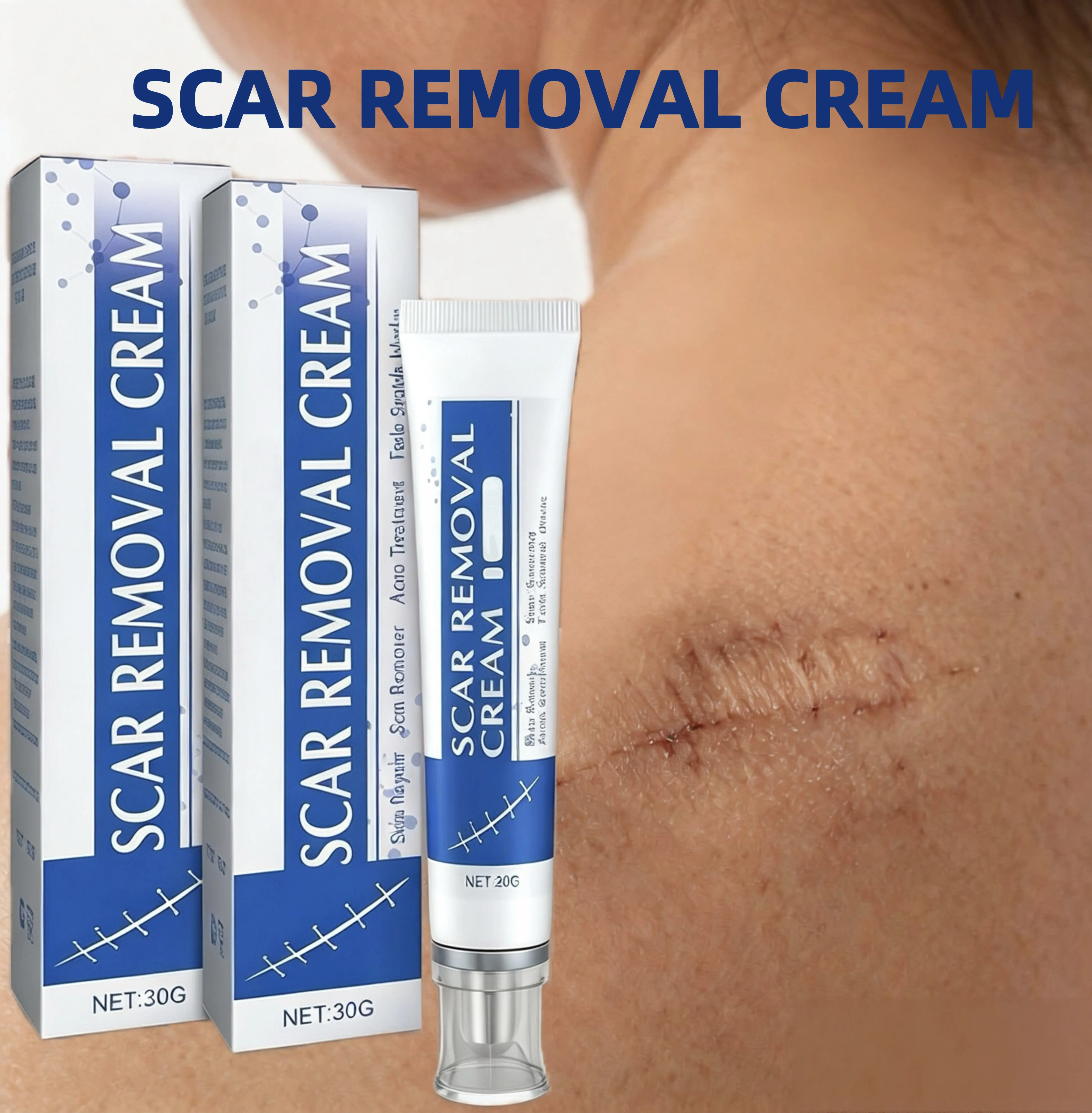 Professional Scar Removal Gel- Scarremoval treatment for keloids, C-sectionS, surgeries, burns, acne andmore.Moisturizing Body Care Cream
