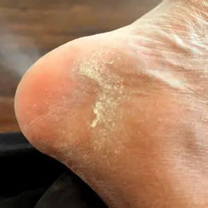 2 in 1 Pedicure Tools Foot Care Kit - Rechargeable Electric Callus Remover and Foot Care Cream - Smooth Pedicure Wand, Anti Cracked Moisturizing Foot Cream -  Remove Dead Skin and Moisturize Dry Skin Cutics Electronic Nail File Cosmetic Manicure Nail Art