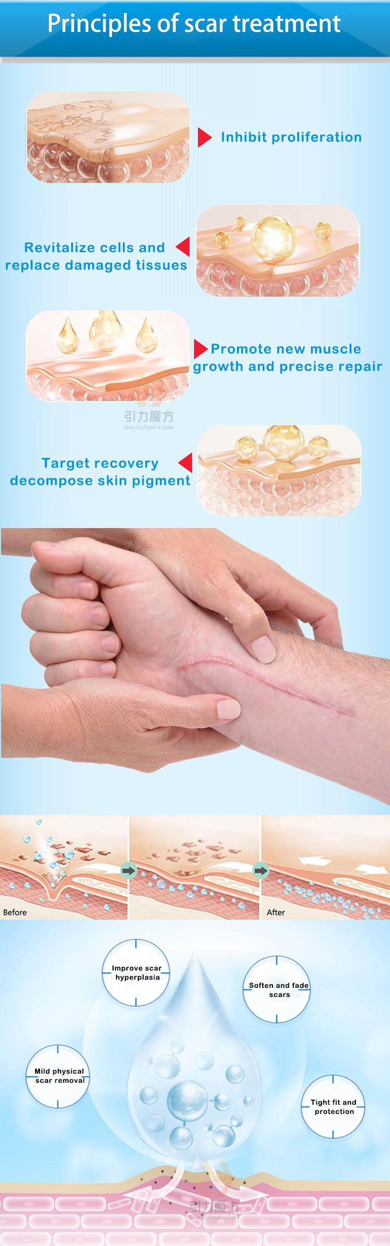 Scar Cream,Professional Scar Removal Gel,Suitable for scar removal treatment of post-operative scars,Caesarean section scars,Keloids,Burns,Acne