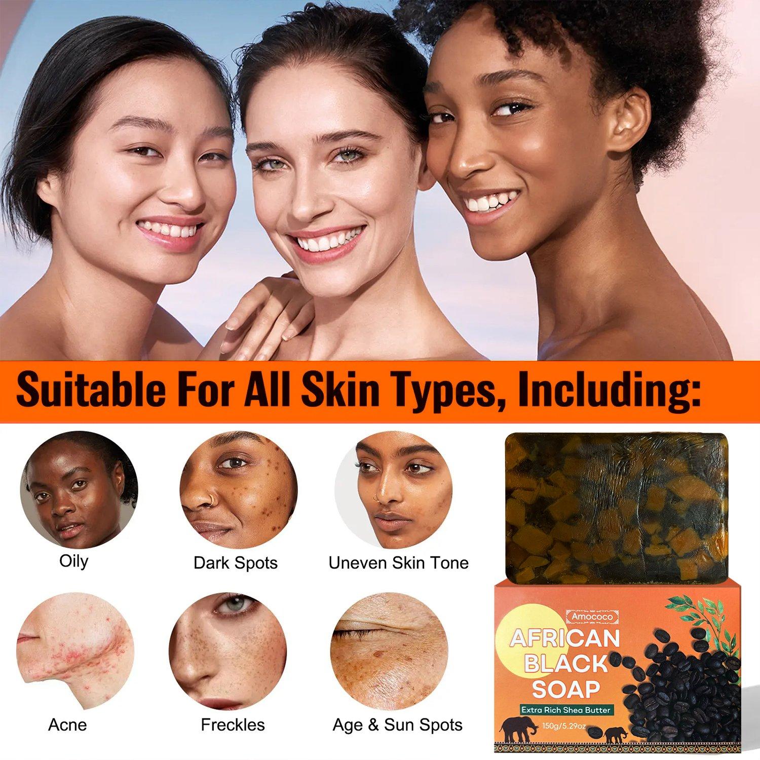 Amococo African Black Soap Bar with Shea Butter | Deep Cleansing, Acne & Dark Spot Fading, Hydrating for All Skin Types 150g