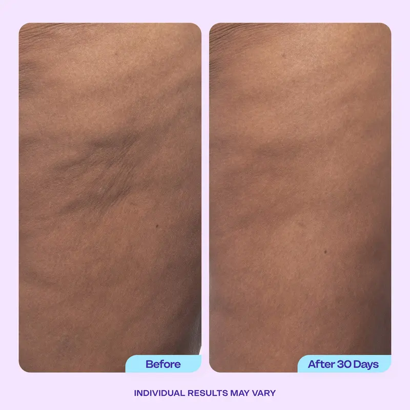 GOPURE Body Confidence Set 8