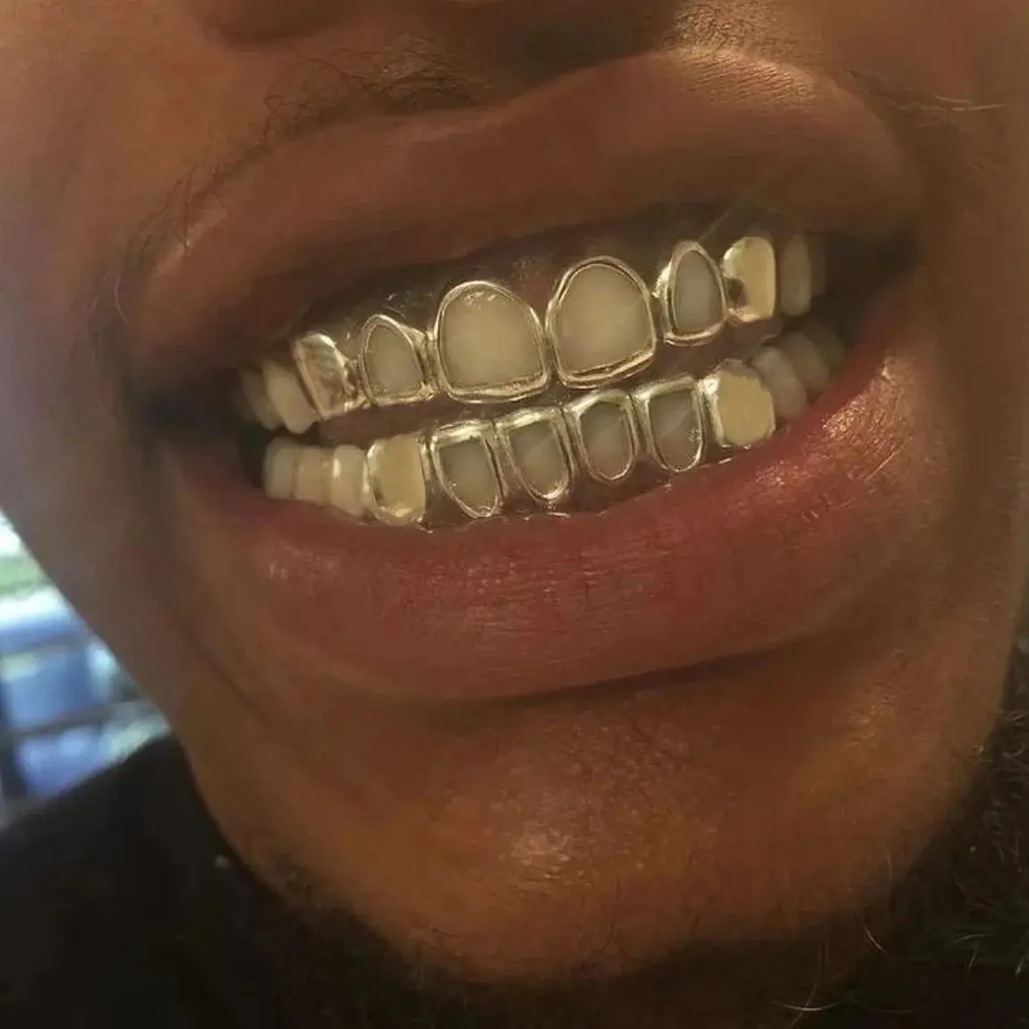 Hip Hop Hollow Teeth Grillz Braces Black Gold Color Glossy Tooth Caps For Women Men Jewelry Dental Grills