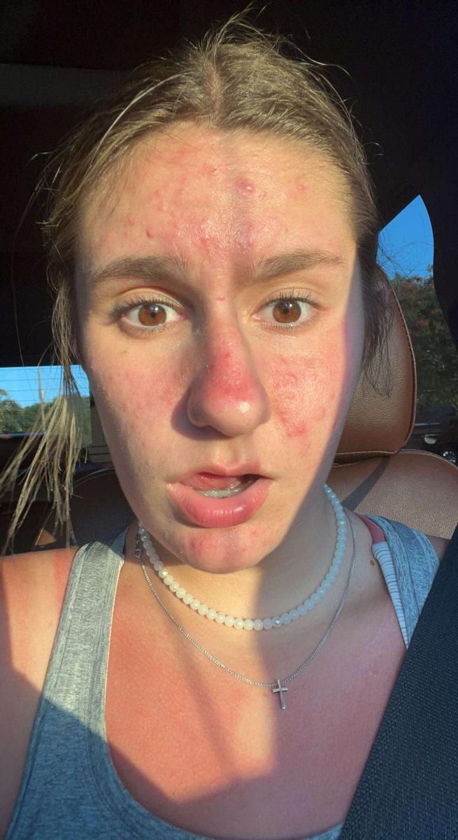 Item: Clear-3 90-Day Supply