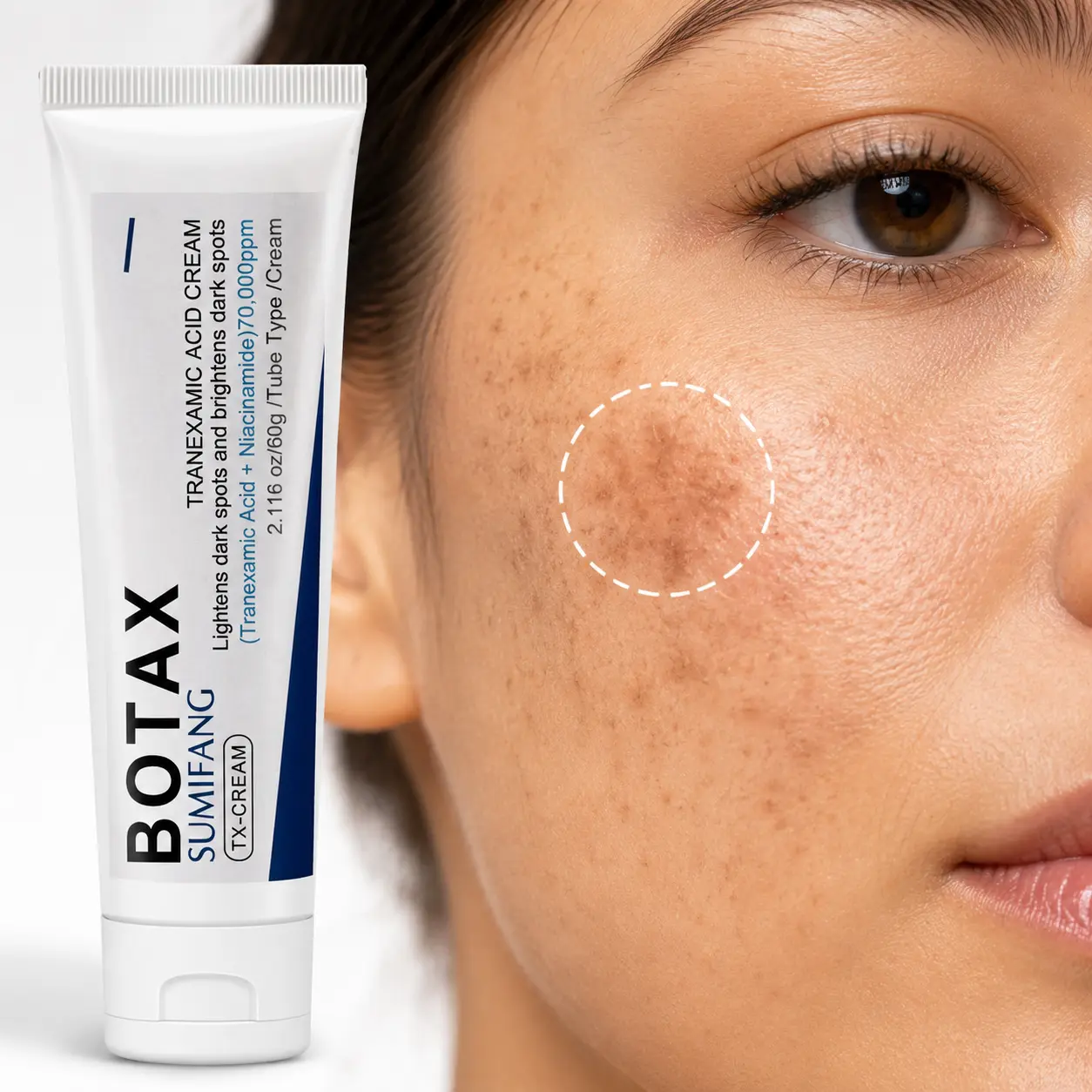 Tranexamic Acid Dark Spot Cream with Niacinamide, Brightening Moisturizer for Uneven Skin Tone & Visible Discoloration, Smooth Radiant-Looking Skin, 60g