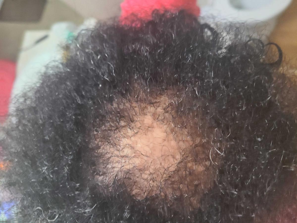 Item: DLHF-HGM-Bundle