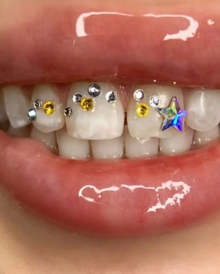 Starz Gemz Mega Pack
