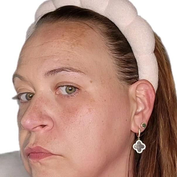 Younique Cream Foundation - Perfect for Blemish-Prone Skin - Balm