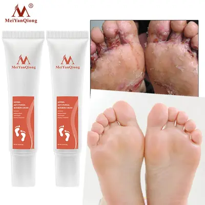 Feet Cream for Fungus TikTok Shop