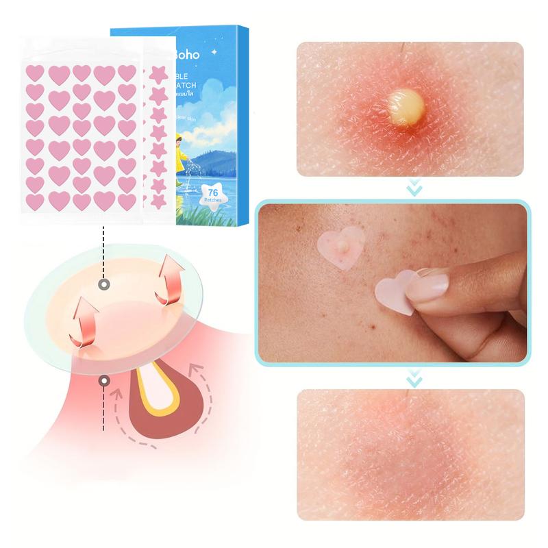 Skin Care Products for Women,Gentle Skin Tag Patches, 76pcs/set Hydrocolloid Acne Care Patches, Moisturizing Facial Skin Care Stickers,  Pimple Patches, Christmas, Christmas Gift