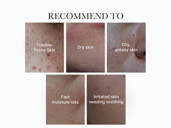 [medicube] Exosome Cica Cream | Hydrating & Soothing Cream with Exosome Cica and Ceramides Lightweight Moisturizer Moisturizing Skincare