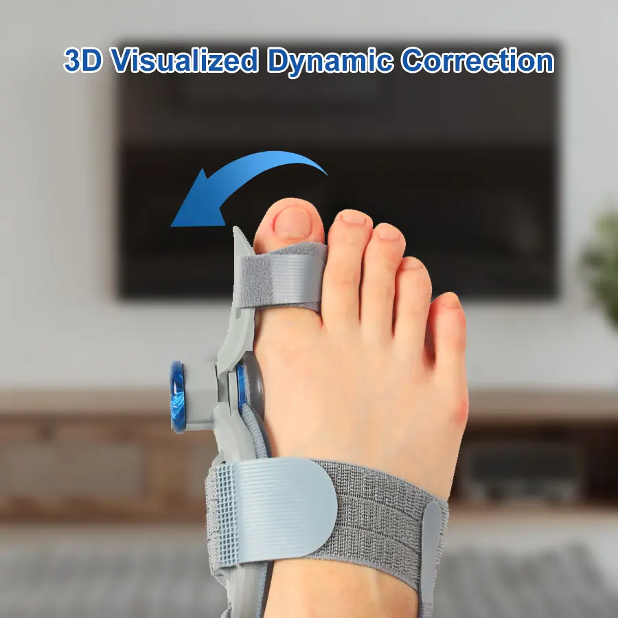 YOSO Unisex Bunion Corrector - Adjustable Knob Splint with Silicone Inner Pad, Orthopedic Big Toe Straightener for Left/Right Ft, Reduces Friction, Relieves Bunion Discomfort, Grey, 1pc