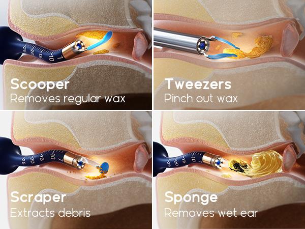 Ear Wax Removal Tool Camera, Flexible Wireless Ear Cleaner with Camera Otoscope Light, HD Painless Visual Ear Picker Tweezers Earwax Remover, Portable Safe Ear Cleaning Kit for Adults & Kids Ear Wax Removal Tool Camera, Flexible Wireless Ear Cleaner with Camera Otoscope Light, HD Painless Visual Ear Picker Tweezers Earwax Remover, Portable Safe Ear Cleaning Kit for Adults & Kids