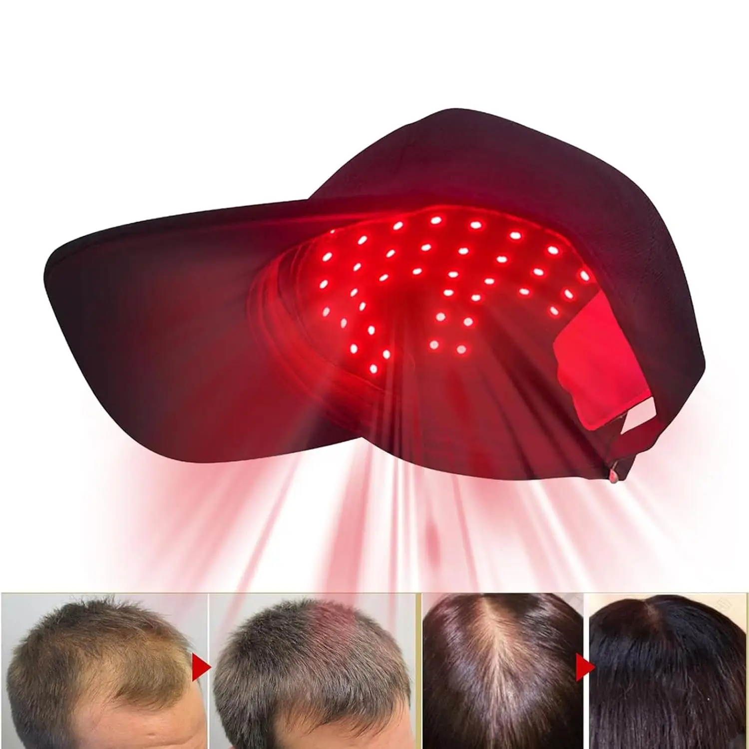 Laser Hair Growth Cap: Helps Reduce Hair Shedding and Promotes Thicker Hair | 56 Lasers & LEDs, Full-Scalp Red Light Therapy