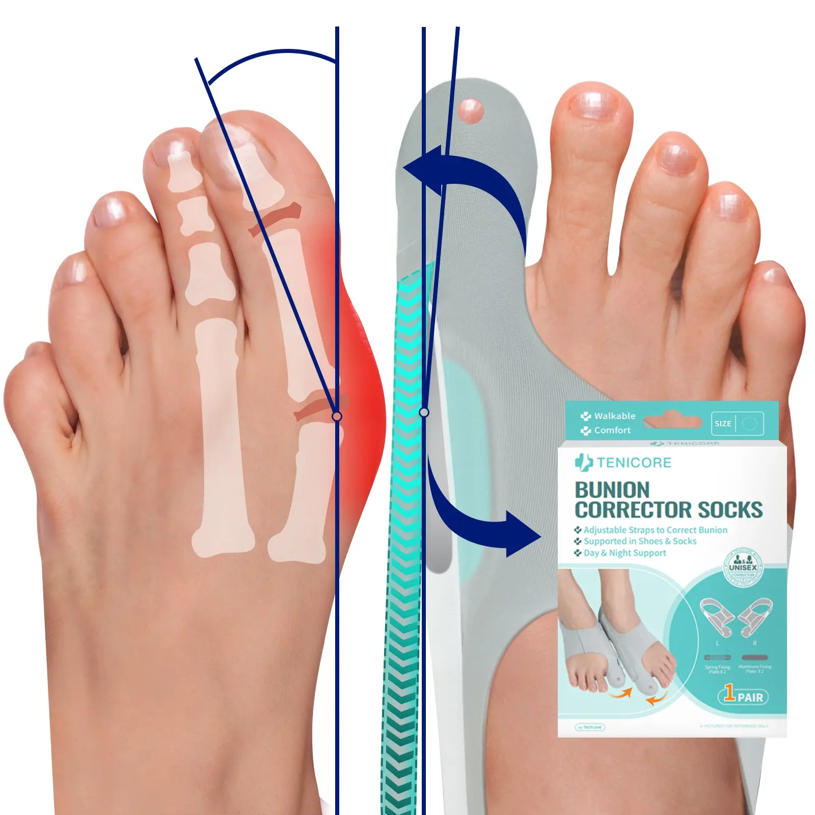 Adjustable Bunion Corrector Socks, Orthopedic Toe Straightener, Big Toe Alignment Sleeve, Toe Separation, Toe Separator, 1 Pair with 4 Fixing Plates, Day & Night Foot Pain Relief, Comfortable Shoe Inserts for Bunions