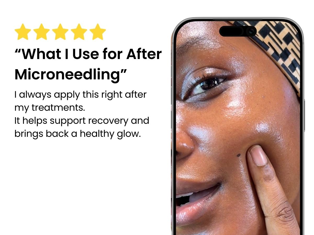 [FRANKLY] PDRN Bounce Ball Serum | 99% Pure Salmon DNA Moisturizer for Skin Repair & Glow Skin | Barrier Repair, Glow Skin, Plumping Effect, Korean Skincare, Lightweight