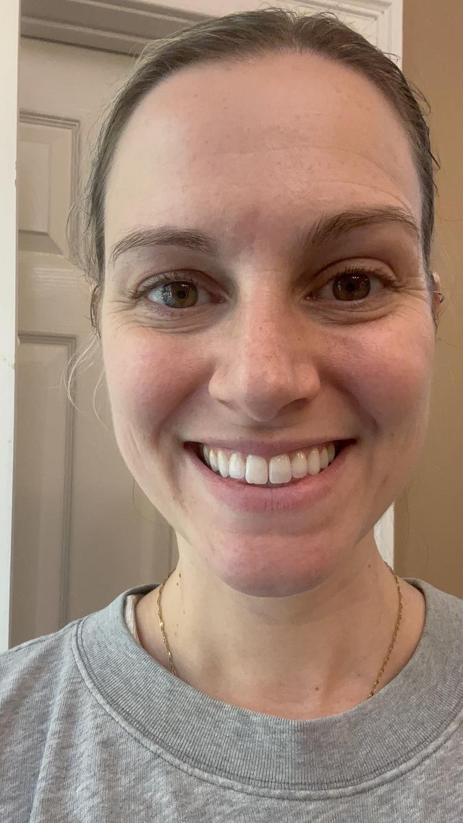 Item: 2 pcs (affordable Pack)